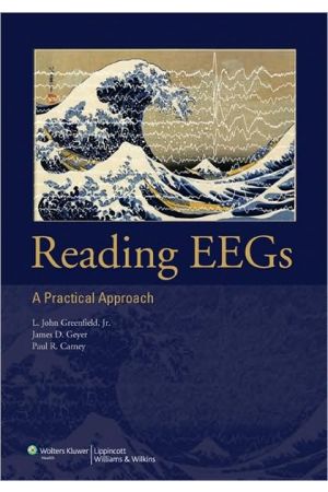 Reading EEGs: A Practical Approach