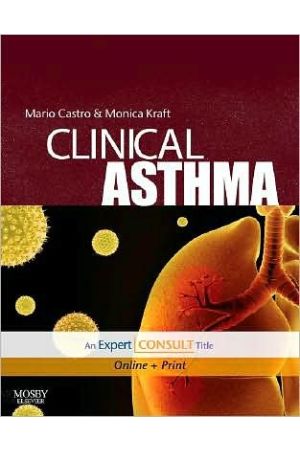 Clinical Asthma: Expert Consult - Online and Print