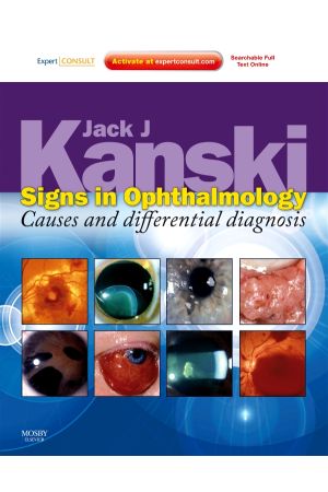 Signs in Ophthalmology: Causes and Differential Diagnosis Expert Consult - Online and Print