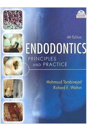 Endodontics, 4th Edition: Principles and Practice