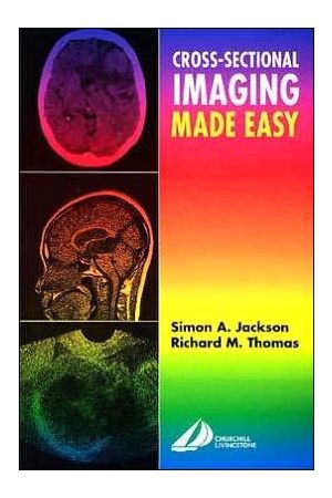 Cross-Sectional Imaging Made Easy, International Edition 