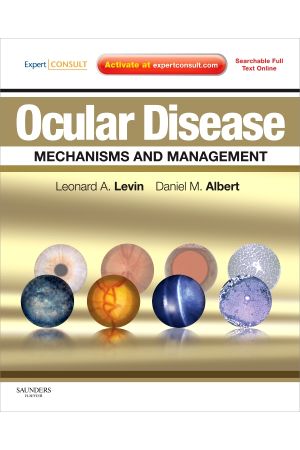 Ocular Disease: Mechanisms and Management: Expert Consult - Online and Print 