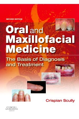 Oral and Maxillofacial Medicine: The Basis of Diagnosis and Treatment, 2nd Edition