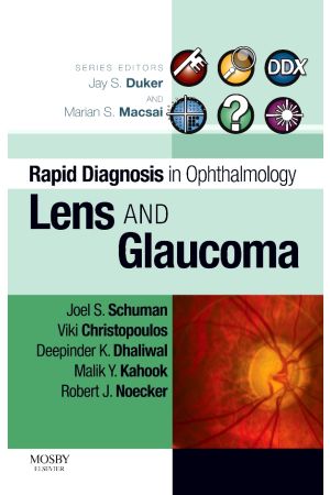 Rapid Diagnosis in Ophthalmology Series: Lens and Glaucoma