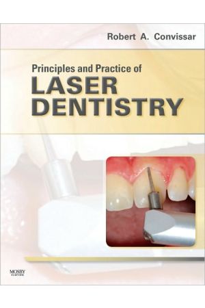 Principles and Practice of Laser Dentistry