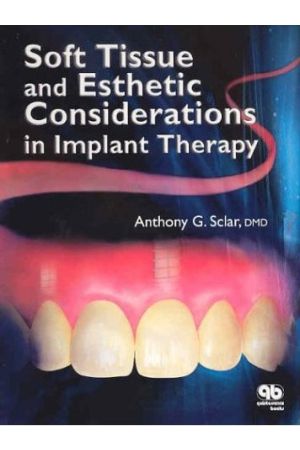 Soft Tissue and Esthetic Considerations in Implant Therapy