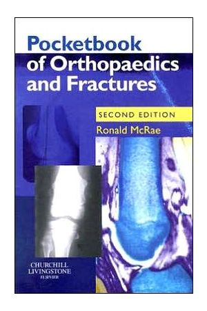 Pocketbook of Orthopaedics and Fractures, International Edition, 2nd Edition