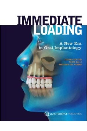 Immediate Loading: A New Era in Oral Implantology