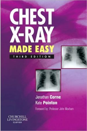Chest X-Ray Made Easy, International Edition, 3rd Edition