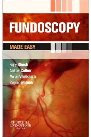 Fundoscopy Made Easy, International Edition
