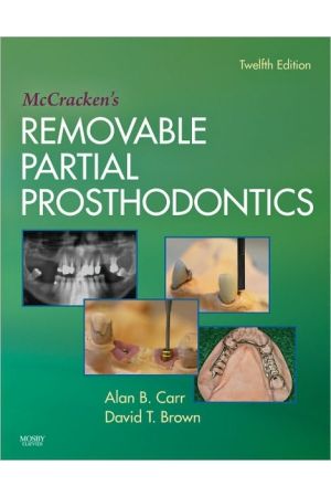 McCracken's Removable Partial Prosthodontics, Edition 12