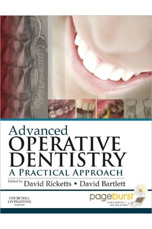 Advanced Operative Dentistry: A Practical Approach