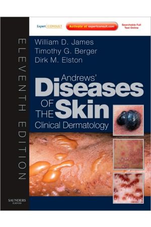 Andrews' Diseases of the Skin, International Edition, 11th edition: Clinical Dermatology - Expert Consult - Online and Print