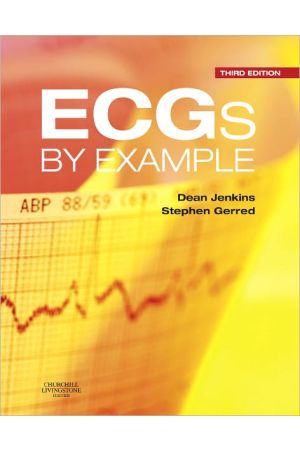ECGs by Example, 3rd Edition