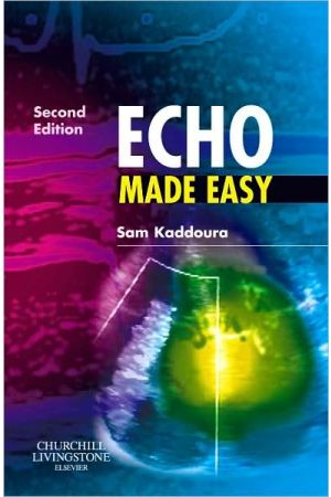 Echo Made Easy International Edition, 2nd Edition
