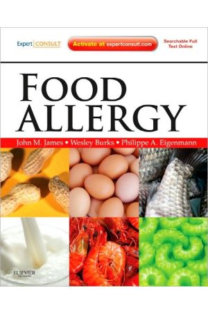 Food Allergy: Expert Consult Basic