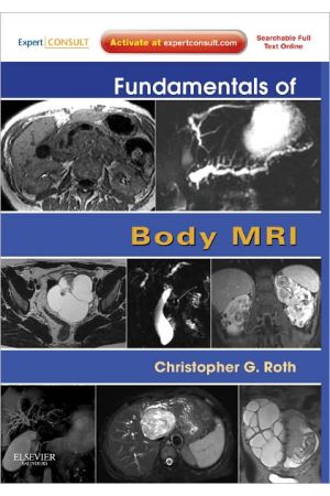 Fundamentals of Body MRI: Expert Consult- Online and Print