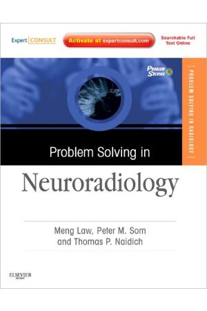 Problem Solving in Neuroradiology: Expert Consult - Online and Print