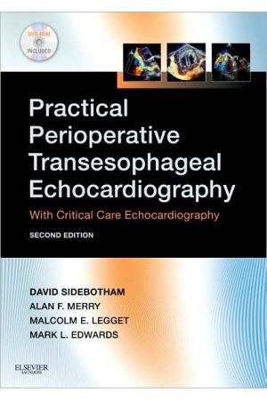 Practical Perioperative Transesophageal Echocardiography, 2nd Edition: : With Critical Care Echocardiography [With DVD ROM]