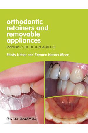 Orthodontic Retainers and Removable Appliances: Principles of Design and Use
