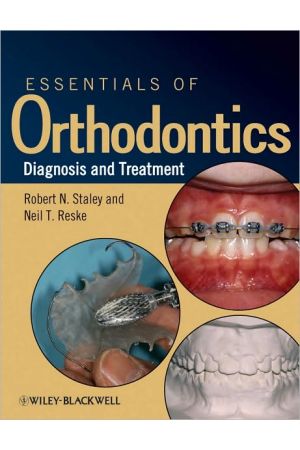 Essentials of Orthodontics: Diagnosis and Treatment