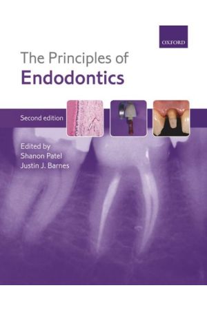 The Principles of Endodontics, second edition