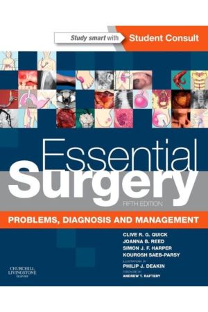 Essential Surgery International Edition, 5th Edition: Problems, Diagnosis and Management With STUDENT CONSULT Online Access