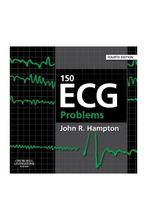 150 ECG Problems, International Edition, 4th Edition