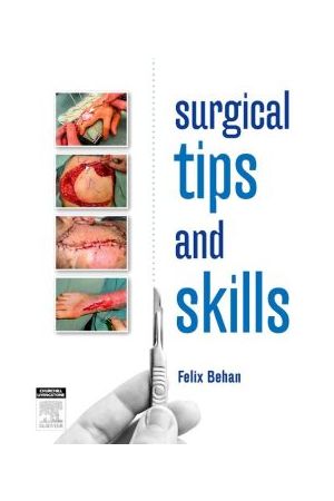 Surgical tips and skills