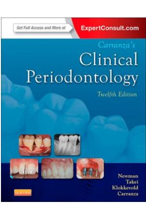 Carranza's Clinical Periodontology, 12e (Expert Consult Title: Online + Print)