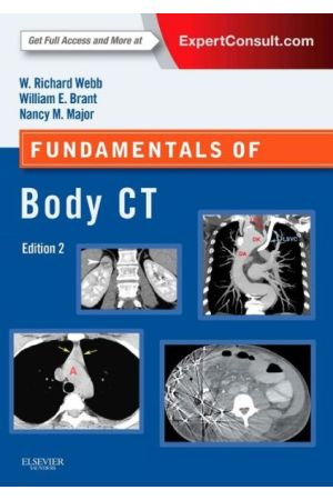 Fundamentals of Body CT, 4th Edition