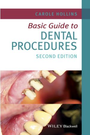 Basic Guide to Dental Procedures, 2nd Edition
