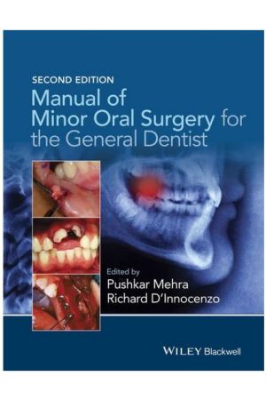 Manual of Minor Oral Surgery for the General Dentist, 2nd Edition