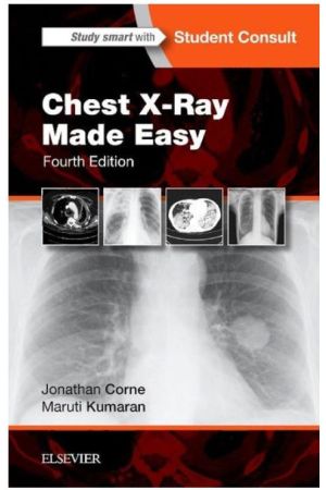 Chest X-Ray Made Easy, International Edition, 4th Edition
