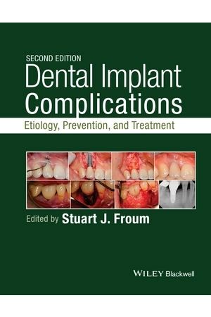 Dental Implant Complications: Etiology, Prevention, and Treatment, 2nd Edition
