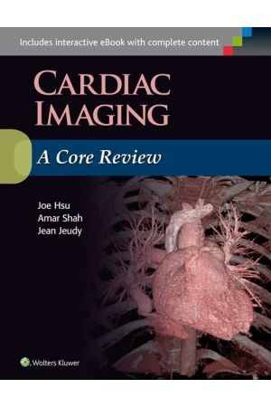 Cardiac Imaging: A Core Review, 1st Edition