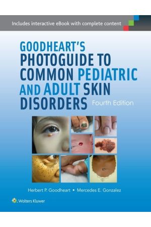 Goodheart's Photoguide to Common Pediatric and Adult Skin Disorders, 4th edition