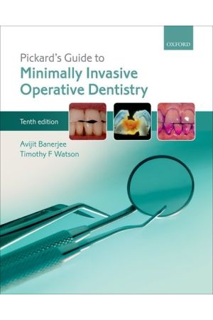 Pickard's Guide to Minimally Invasive Operative Dentistry, 10th edition