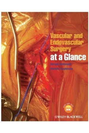 Vascular and Endovascular Surgery at a Glance