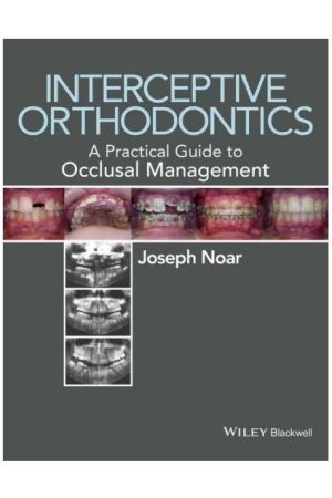 Interceptive Orthodontics: A Practical Guide to Occlusal Management, 1st Edition