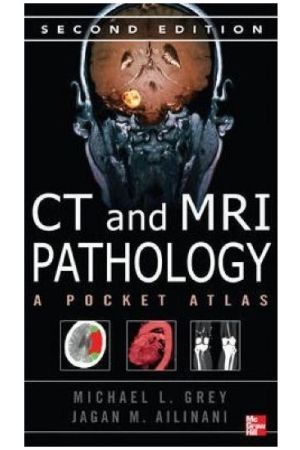 CT & MRI Pathology: A Pocket Atlas, 2nd edition