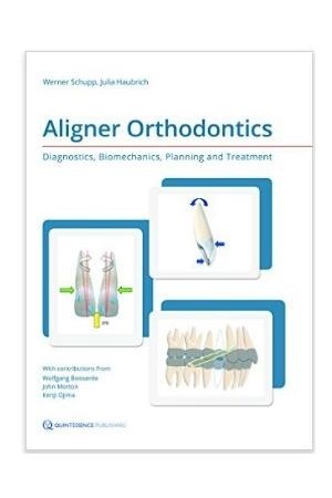 Aligner Orthodontics: Diagnostics, Biomechanicals, Planning and Treatment