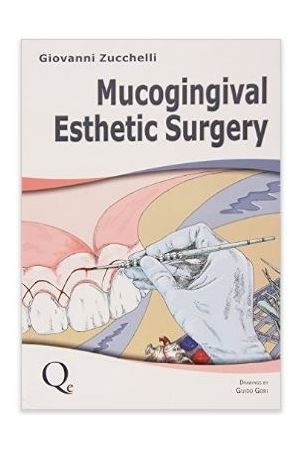 Mucogingival Esthetic Surgery 2 Vol Set, 1st Edition