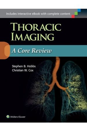 Thoracic Imaging: A Core Review, 1st Edition
