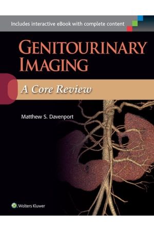 Genitourinary Imaging: A Core Review, 1st Edition