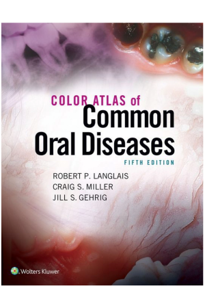 Color Atlas of Common Oral Diseases, 5th Edition