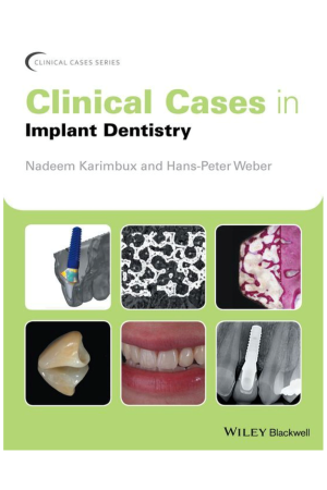 Clinical Cases in Implant Dentistry, 1st edition
