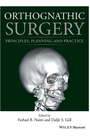 Orthognathic Surgery: Principles, Planning and Practice, 1st Edition