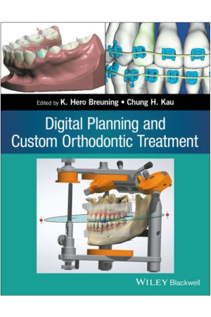 Digital Planning and Custom Orthodontic Treatment, 1st Edition