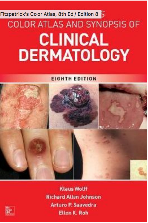 FITZPATRICK'S COLOR ATLAS AND SYNOPSIS OF CLINICAL DERMATOLOGY, 8th Edition